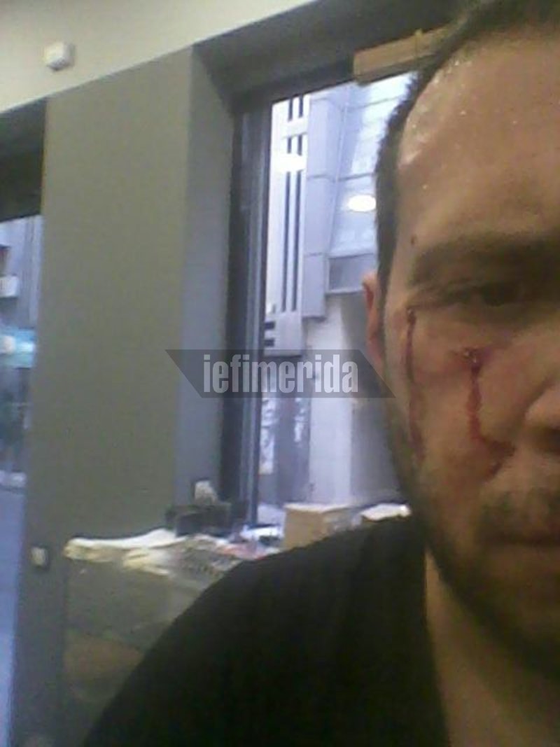 Αποκλειστικό: Αγριο ξύλο σε οδοντίατρο, κάτοικο Εξαρχείων -Tους είχε κάνει παρατήρηση για τη μουσική | iefimerida.gr 0