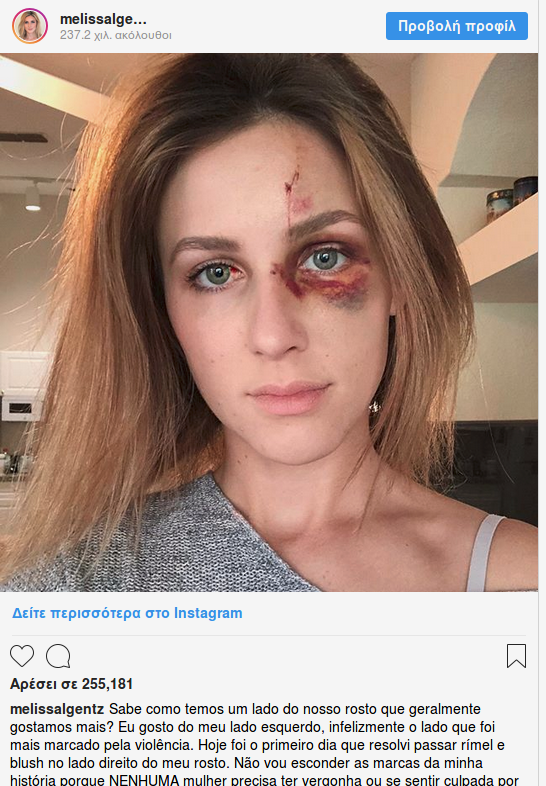 Πλουσιόπαιδο της Βραζιλίας έδειρε διάσημη σταρ του Instagram -Μια απίστευτη ιστορία [εικόνες] | iefimerida.gr 0