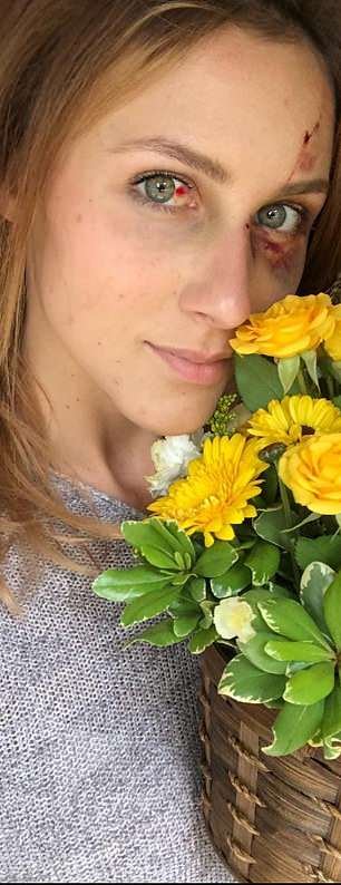 Πλουσιόπαιδο της Βραζιλίας έδειρε διάσημη σταρ του Instagram -Μια απίστευτη ιστορία [εικόνες] | iefimerida.gr 4