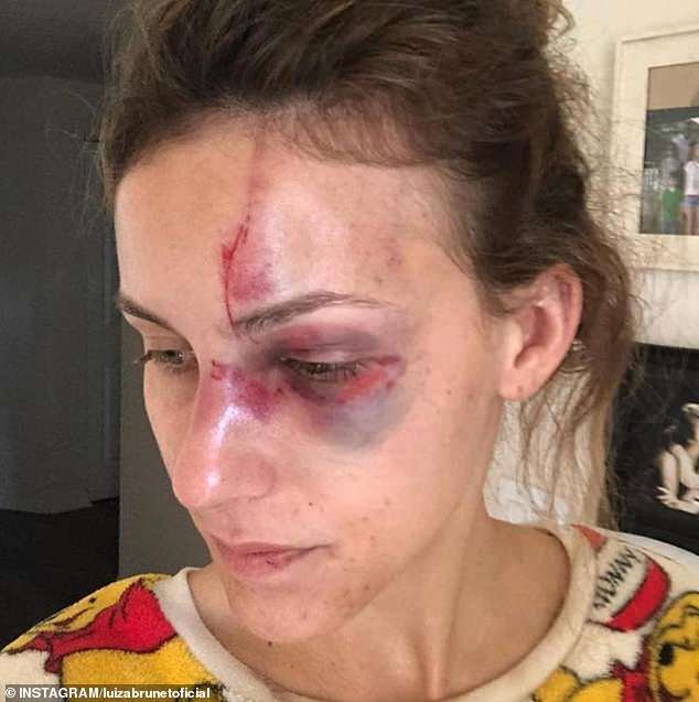 Πλουσιόπαιδο της Βραζιλίας έδειρε διάσημη σταρ του Instagram -Μια απίστευτη ιστορία [εικόνες] | iefimerida.gr 1