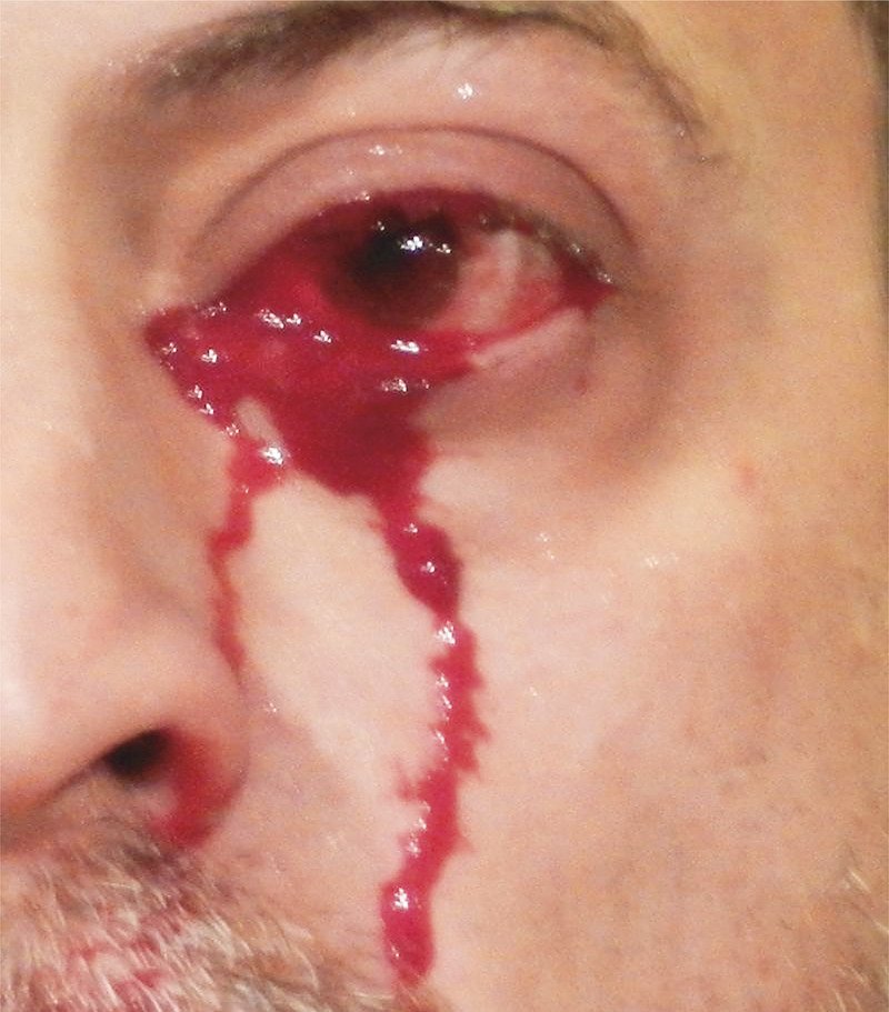 Η φωτογραφία του 52χρονου που δημοσίευσε το περιοδικό New England Journal of Medicine