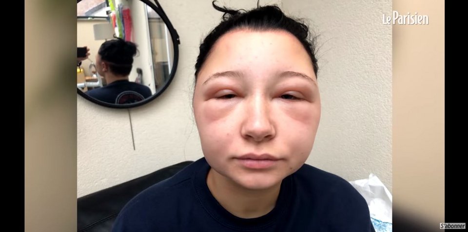 Κινδύνευσε να πεθάνει από βαφή μαλλιών -Η υπόθεση που σόκαρε τη Γαλλία [εικόνες] | iefimerida.gr 1