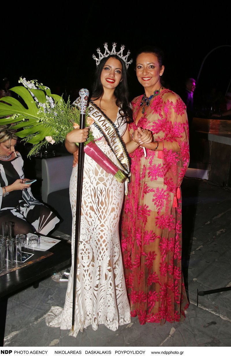 Μίλησε για την νόσο του Bell που την άφησε καθηλωμένη για δύο χρόνια και σόκαρε.