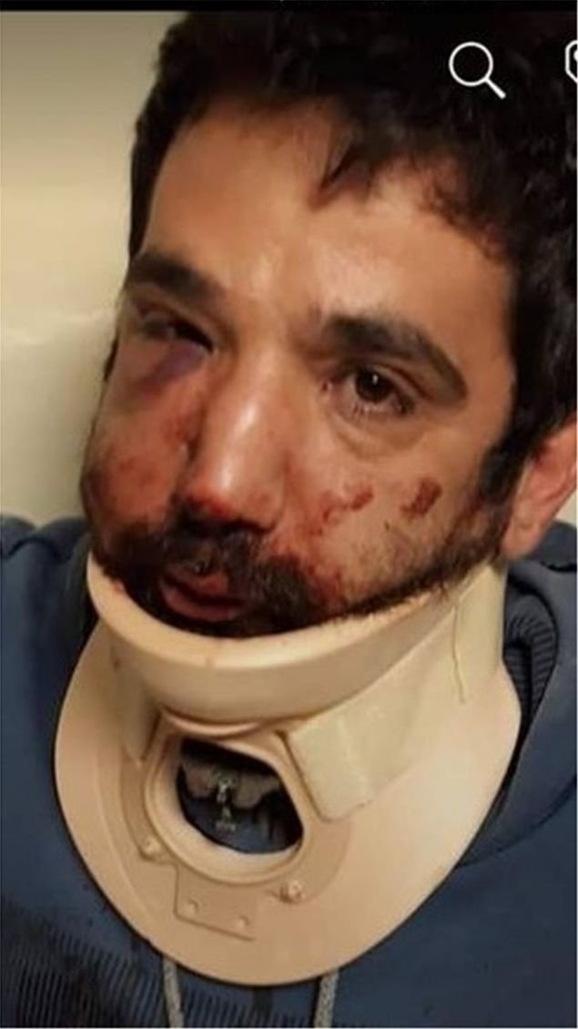 Σοκ από τις φωτό του άσχημα χτυπημένου ντελιβερά -Τον χτύπησε ο εργοδότης του [εικόνες] | iefimerida.gr 0