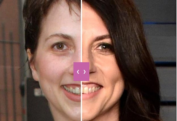 Πώς ο Τζεφ Μπέζος και η γυναίκα του από άσχημοι έγιναν γκλαμουράτοι και σικάτοι -Μεταμόρφωση εκατ. με πλαστικές [εικόνες] | iefimerida.gr 1