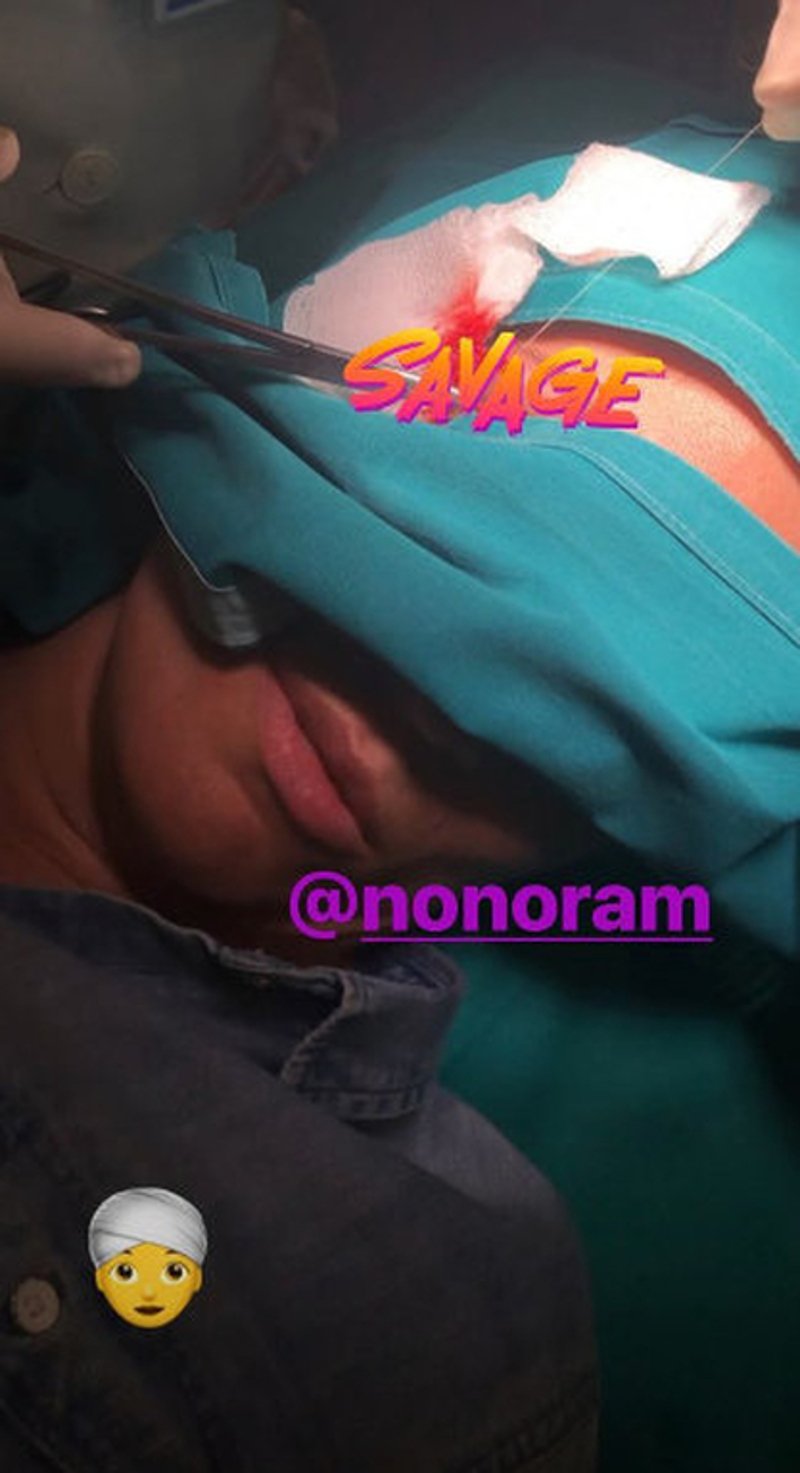 Ατύχημα για την Ελεονώρα Μελέτη -Εκανε ράμματα στο κεφάλι [εικόνα] | iefimerida.gr 0