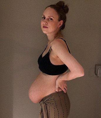 Μητέρα με τρίδυμα δείχνει ωμά πώς είναι η κοιλιά της μετά τη γέννα [εικόνες] | iefimerida.gr 1