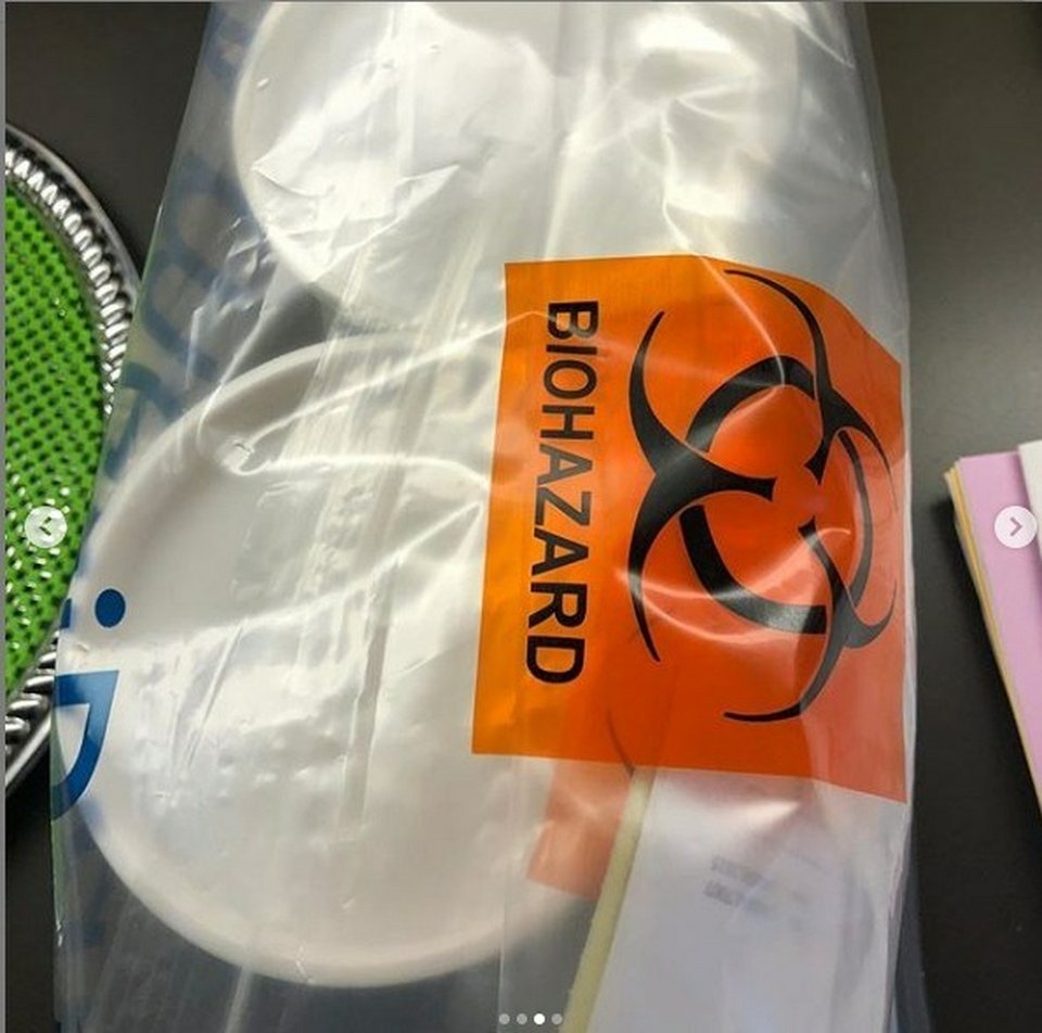 Η σεξοβόμβα πρώην του Αλκη Δαυίδ έβγαλε τη σιλικόνη από το στήθος και το έδειξε καρέ καρέ [εικόνες] | iefimerida.gr 2