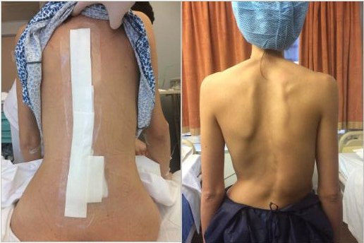 Ρομποτική χειρουργική της σπονδυλικής στήλης: Tο πιο σύγχρονο επίτευγμά της βρίσκεται πλέον στο Μetropolitan | iefimerida.gr 3