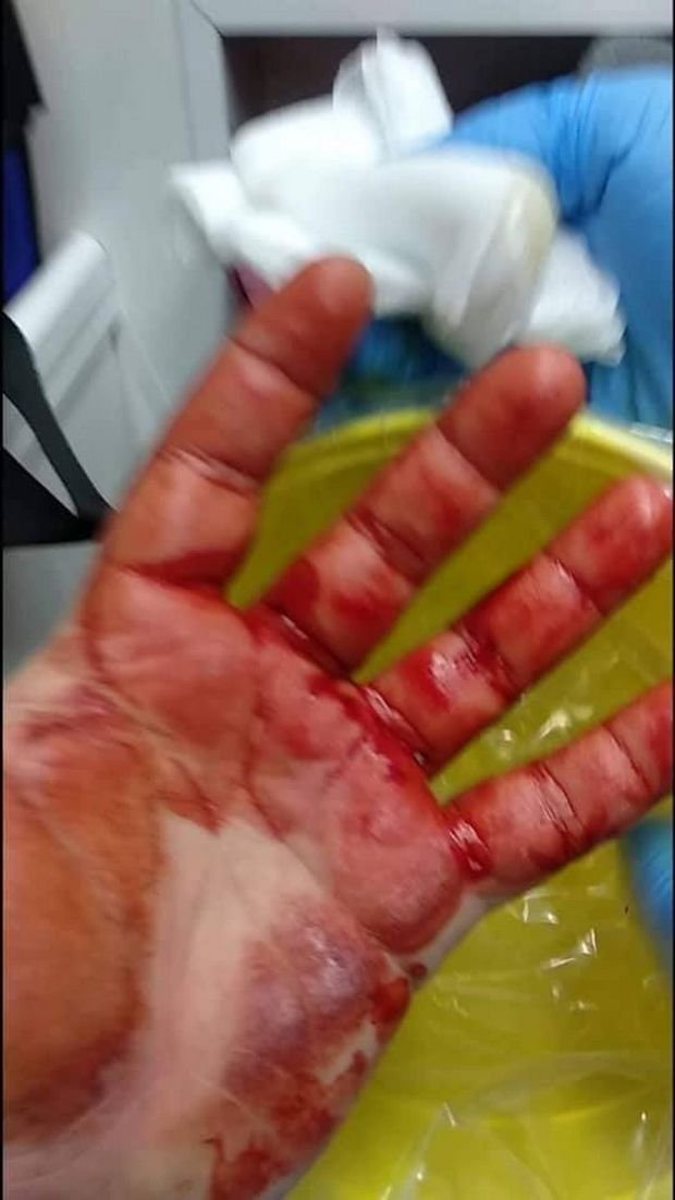 Εγκληματική χαρακτηρίζει την επίθεση ο Εθνικός