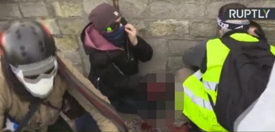 Φρίκη στο Παρίσι: Διαδηλωτής έχασε το χέρι του από δακρυγόνο σε πορεία των Κίτρινων Γιλέκων -Σκληρές εικόνες | iefimerida.gr 0