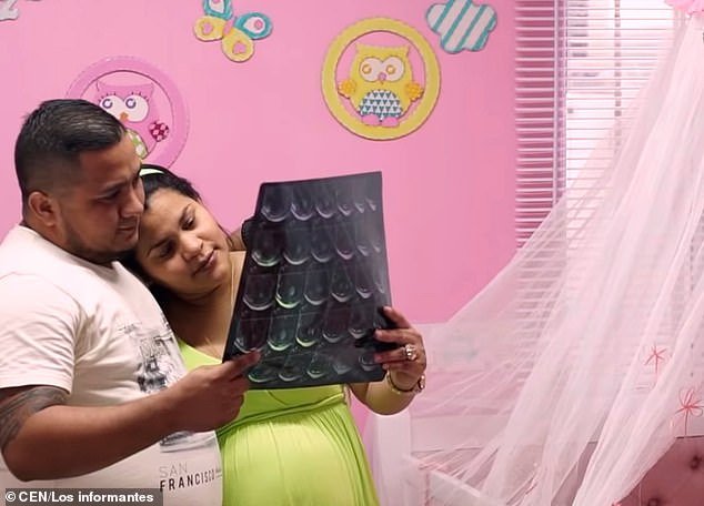 Απίστευτο: Κοριτσάκι γεννήθηκε έγκυος στην Κολομβία! [εικόνες] | iefimerida.gr 4