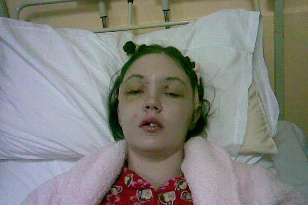 Σοκ: 35χρονη έχασε το μισό μέτωπό της σε τροχαίο -Είχε τα πόδια στο ταμπλό του αυτοκινήτου [εικόνες] | iefimerida.gr 4