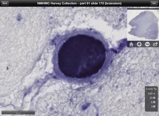 Πώς μπορείς να έχεις τον εγκέφαλο του Άινστάϊν στην οθόνη σου! [εικόνες] | iefimerida.gr 3