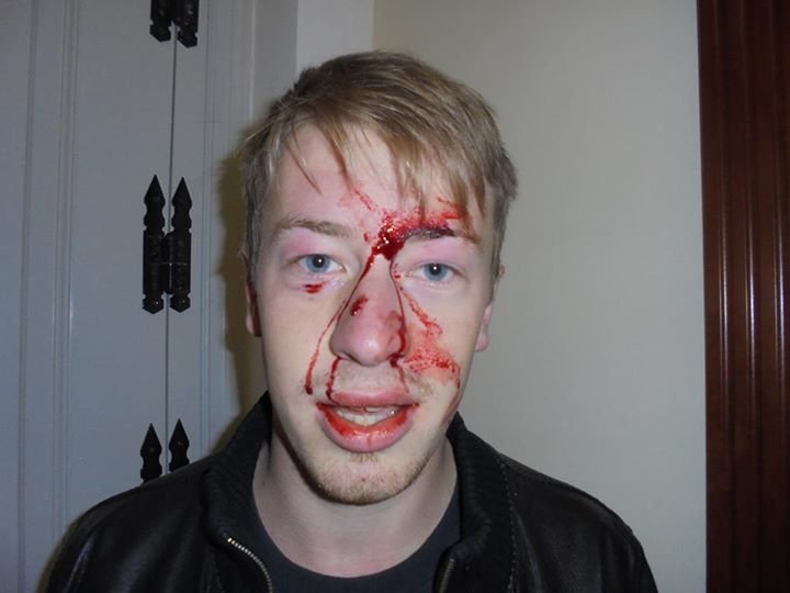 Γερμανός φοιτητής καταγγέλλει: Με χτύπησαν τα ΜΑΤ -Δεν ήμουν καν στην πορεία [εικόνες] | iefimerida.gr 0