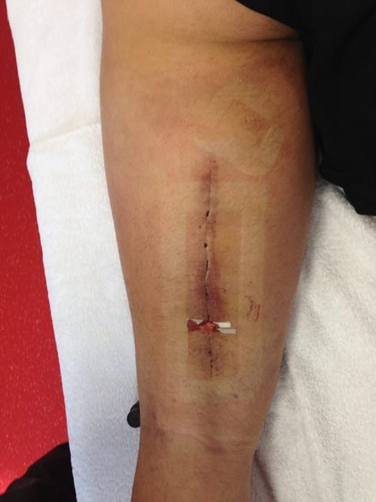 Σοκάρουν οι φωτογραφίες από τραυματισμό παίκτη της Γιουβέντους [εικόνες] | iefimerida.gr 1