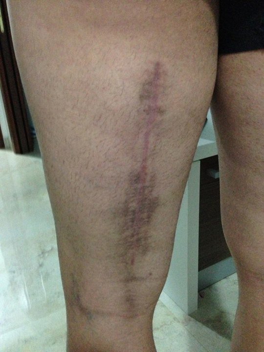 Σοκάρουν οι φωτογραφίες από τραυματισμό παίκτη της Γιουβέντους [εικόνες] | iefimerida.gr 2