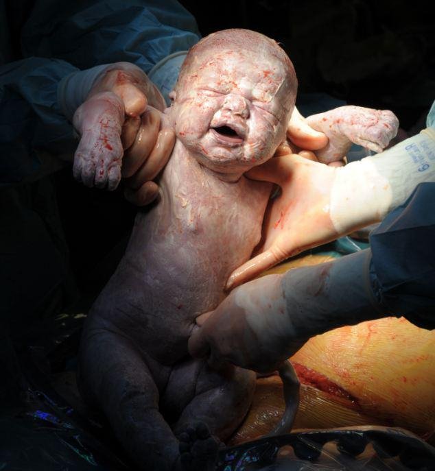 Η πρώτη ανάσα: Συγκλονιστικές φωτογραφίες καταγράφουν το θαύμα της γέννησης [εικόνες] | iefimerida.gr 9