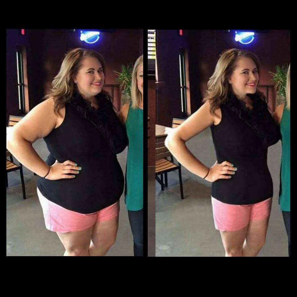 Σελίδα στο facebook κάνει bullying σε παχύσαρκες -Kλέβει φωτογραφίες και τους δείχνει πώς θα ήταν αδύνατες [εικόνες] | iefimerida.gr 3