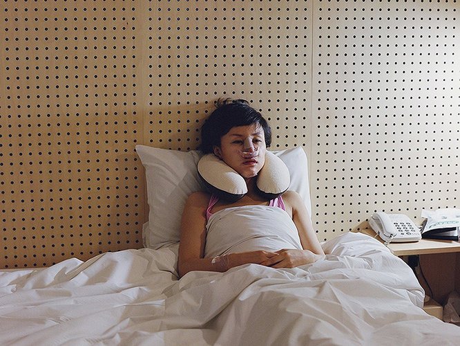 Σοκαριστικά πορτραίτα γυναικών έπειτα από πλαστική χειρουργική [εικόνες] | iefimerida.gr 5