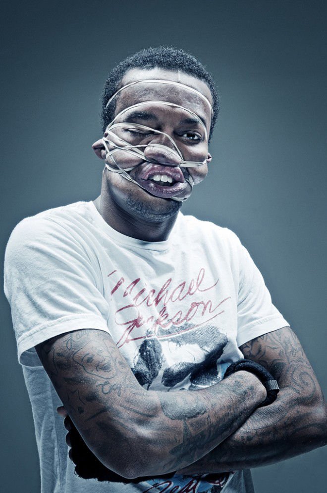 Τερατώδη πορτραίτα τεχνητά παραμορφωμένων ανθρώπων [εικόνες] | iefimerida.gr 4