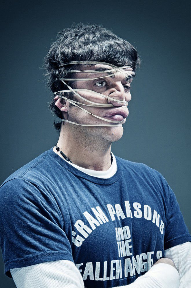 Τερατώδη πορτραίτα τεχνητά παραμορφωμένων ανθρώπων [εικόνες] | iefimerida.gr 8