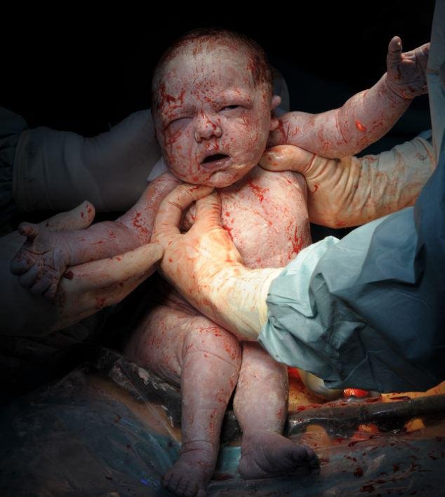 Η πρώτη ανάσα: Συγκλονιστικές φωτογραφίες καταγράφουν το θαύμα της γέννησης [εικόνες] | iefimerida.gr 0