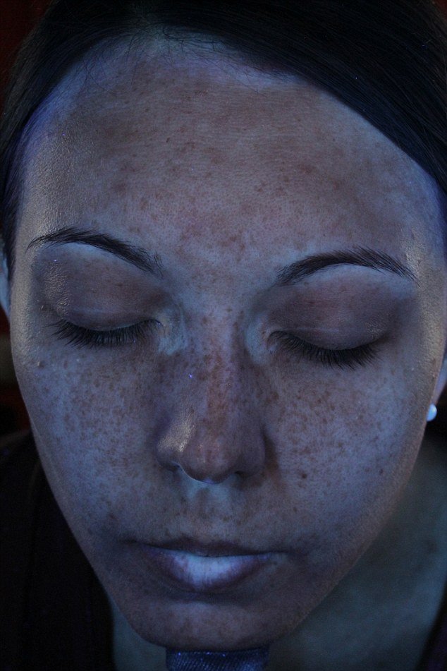 Φωτογραφίες που βοηθούν στην αποφυγή καρκίνου του δέρματος -Πώς προστατεύει το αντηλιακό [εικόνες] | iefimerida.gr 0