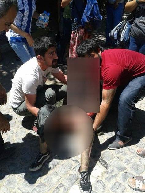 Τουρκία: Λουτρό αίματος με 27 νεκρούς σε πολιτιστικό κέντρο από επίθεση αυτοκτονίας [εικόνες] | iefimerida.gr 3