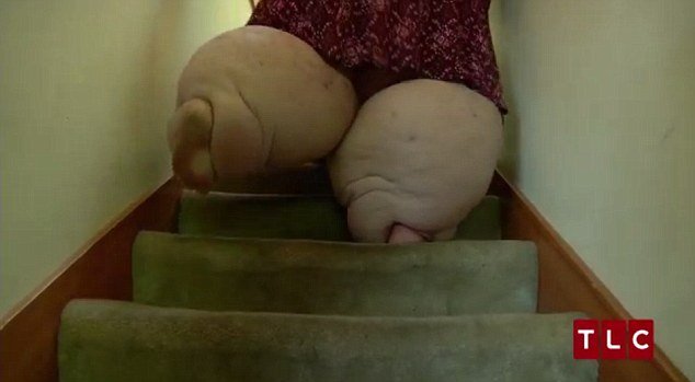 Σοκάρει -Η καθημερινότητα μιας 24χρονης που ζυγίζει 300 κιλά [εικόνες & βίντεο] | iefimerida.gr 2