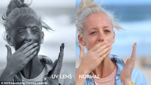 Φωτογραφίες σοκ: Το πείραμα που δείχνει πώς και κατά πόσο προστατεύει το αντηλιακό το δέρμα [εικόνες] | iefimerida.gr 1