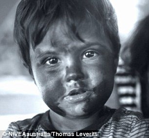 Φωτογραφίες σοκ: Το πείραμα που δείχνει πώς και κατά πόσο προστατεύει το αντηλιακό το δέρμα [εικόνες] | iefimerida.gr 5