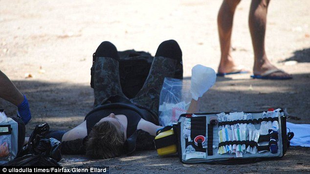 Του έφαγε το χέρι καρχαρίας ενώ ψάρευε: Καρέ καρέ η επίθεση [βίντεο] | iefimerida.gr 2