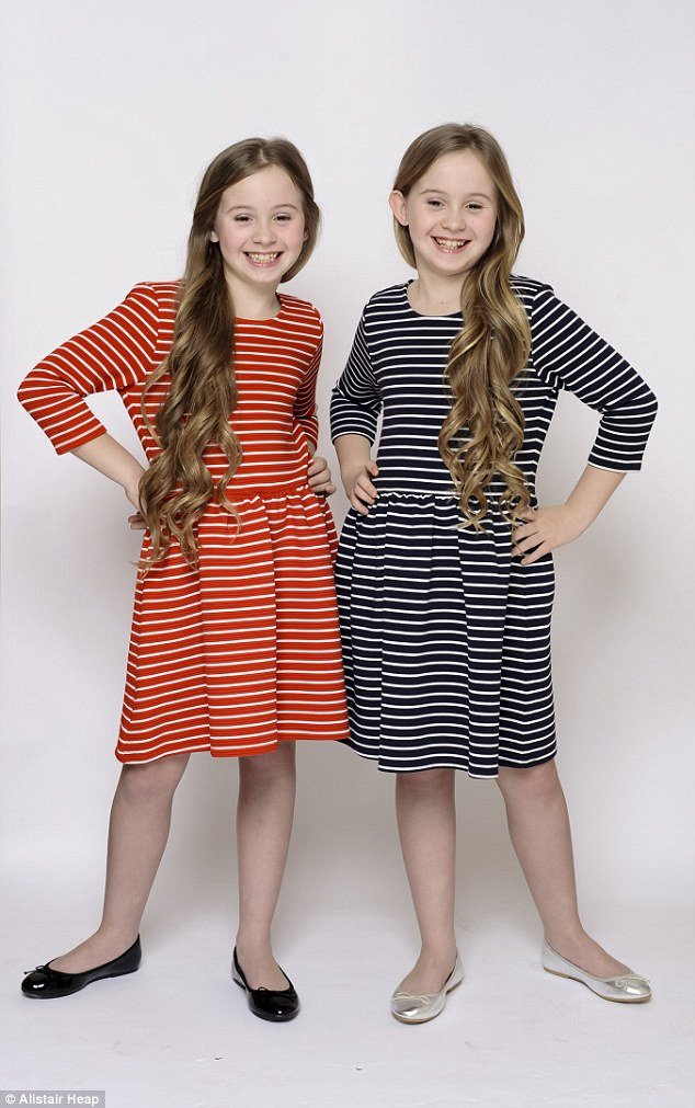 Ιδιαίτερα παιδιά: Τι είναι τα κατοπτρικά δίδυμα που συμπληρώνουν το ένα το άλλο [εικόνες] | iefimerida.gr 0