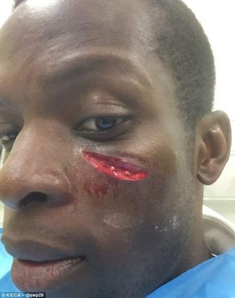 Τραυματισμός σοκ για παίκτη της Premier League [εικόνες] | iefimerida.gr 1