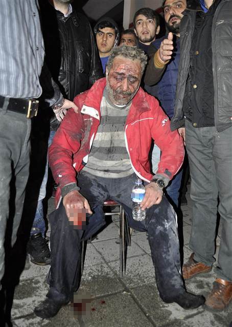 Βόμβα σε γραφεία περιοδικού στην Κωνσταντινούπολη – Ενας νεκρός και τρεις τραυματίες [εικόνες & βίντεο] | iefimerida.gr 3