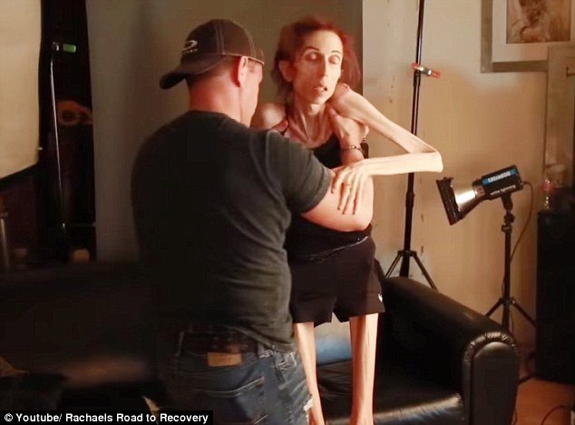 37χρονη με ανορεξία καταφέρνει να περπατήσει για πρώτη φορά μετά από μήνες [βίντεο] | iefimerida.gr 6