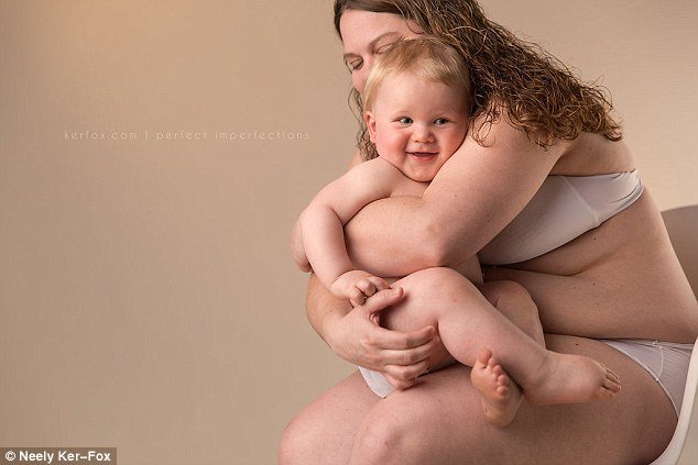 Ραγάδες, τομές και άλλες... ατέλειες: Ετσι είναι το σώμα μετά τη γέννα [εικόνες] | iefimerida.gr 0