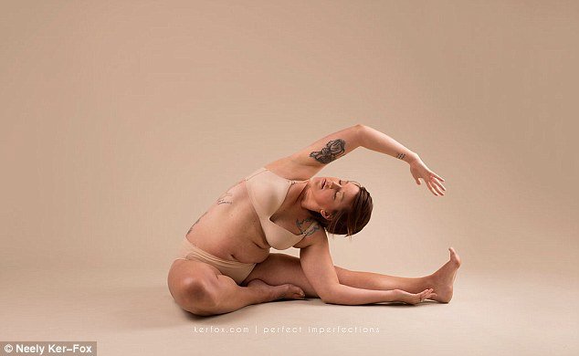 Ραγάδες, τομές και άλλες... ατέλειες: Ετσι είναι το σώμα μετά τη γέννα [εικόνες] | iefimerida.gr 5