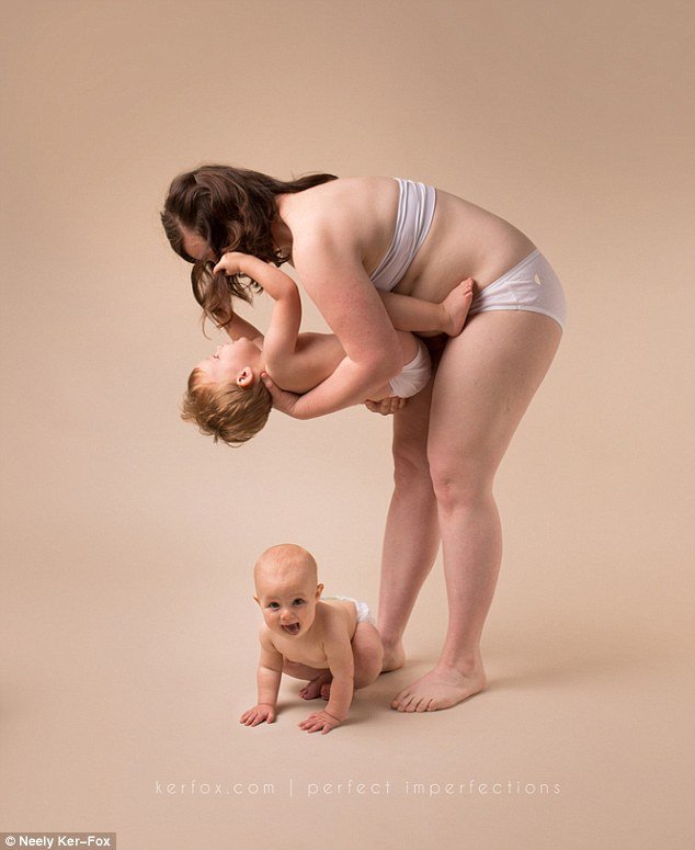 Ραγάδες, τομές και άλλες... ατέλειες: Ετσι είναι το σώμα μετά τη γέννα [εικόνες] | iefimerida.gr 3