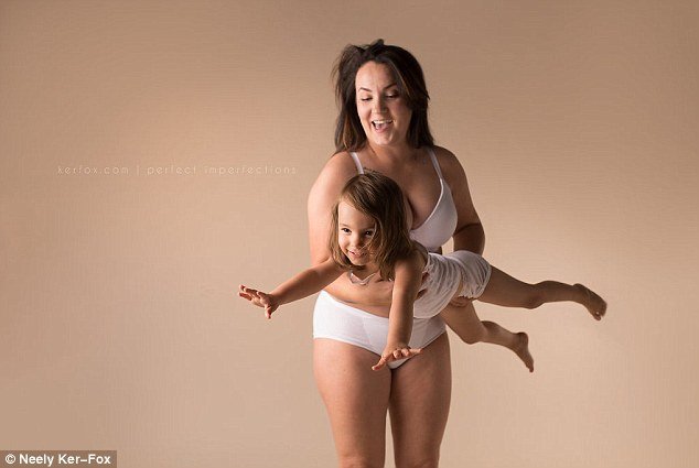 Ραγάδες, τομές και άλλες... ατέλειες: Ετσι είναι το σώμα μετά τη γέννα [εικόνες] | iefimerida.gr 8