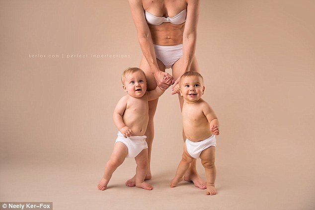 Ραγάδες, τομές και άλλες... ατέλειες: Ετσι είναι το σώμα μετά τη γέννα [εικόνες] | iefimerida.gr 9