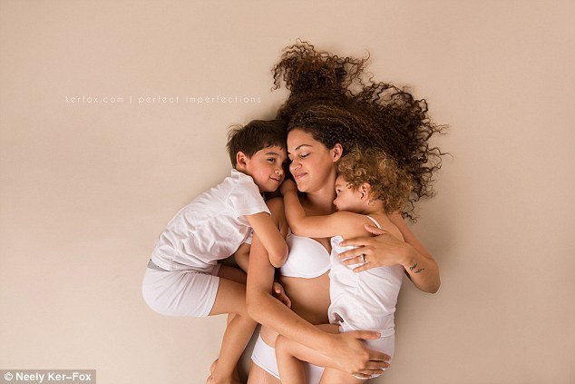 Ραγάδες, τομές και άλλες... ατέλειες: Ετσι είναι το σώμα μετά τη γέννα [εικόνες] | iefimerida.gr 10