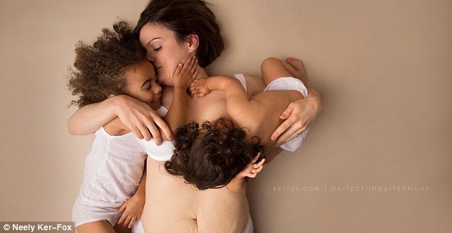 Ραγάδες, τομές και άλλες... ατέλειες: Ετσι είναι το σώμα μετά τη γέννα [εικόνες] | iefimerida.gr 11