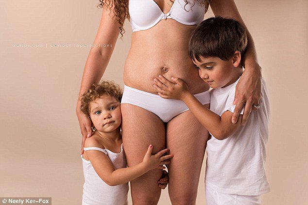 Ραγάδες, τομές και άλλες... ατέλειες: Ετσι είναι το σώμα μετά τη γέννα [εικόνες] | iefimerida.gr 4