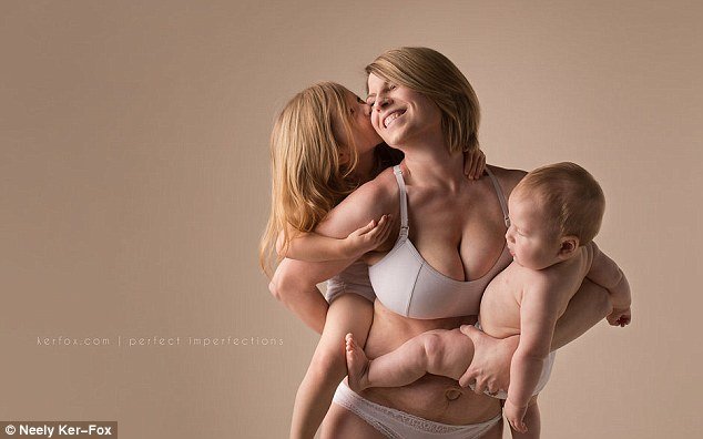 Ραγάδες, τομές και άλλες... ατέλειες: Ετσι είναι το σώμα μετά τη γέννα [εικόνες] | iefimerida.gr 12