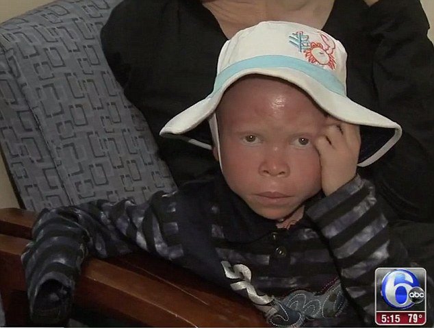 Απαγωγές, ακρωτηριασμοί και δολοφονίες: Η τρομακτική ζωή των αλμπίνων στην  Τανζανία [εικόνες] | iefimerida.gr 0