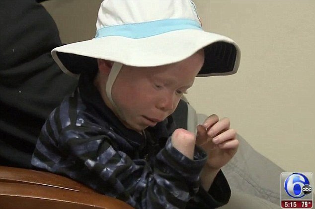 Απαγωγές, ακρωτηριασμοί και δολοφονίες: Η τρομακτική ζωή των αλμπίνων στην  Τανζανία [εικόνες] | iefimerida.gr 1