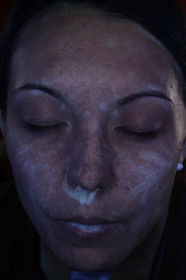 Φωτογραφίες που βοηθούν στην αποφυγή καρκίνου του δέρματος -Πώς προστατεύει το αντηλιακό [εικόνες] | iefimerida.gr 1