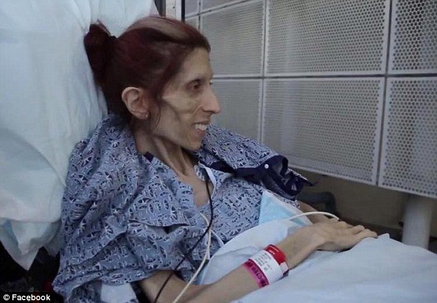 37χρονη με ανορεξία καταφέρνει να περπατήσει για πρώτη φορά μετά από μήνες [βίντεο] | iefimerida.gr 7